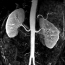 Renal Artery MRA